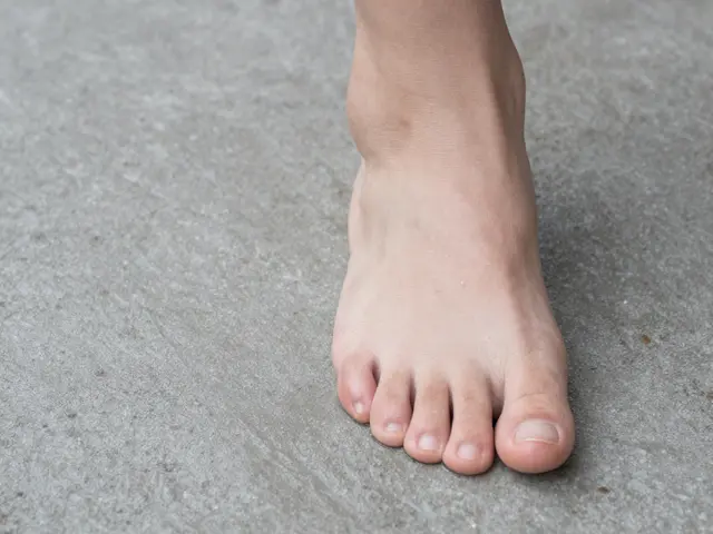 Jak poznat ploché nohy: Příznaky, vliv na reflexní masáž a co s tím dělat
